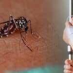 Dengue fever symptoms